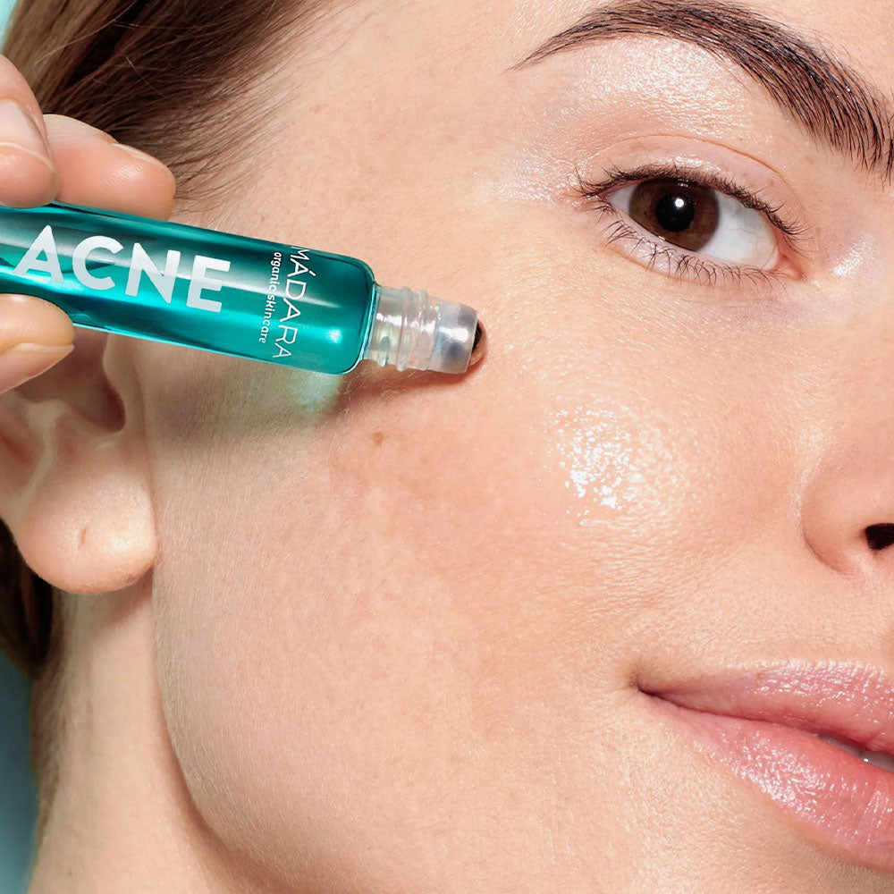 Acne Spot Roll-On